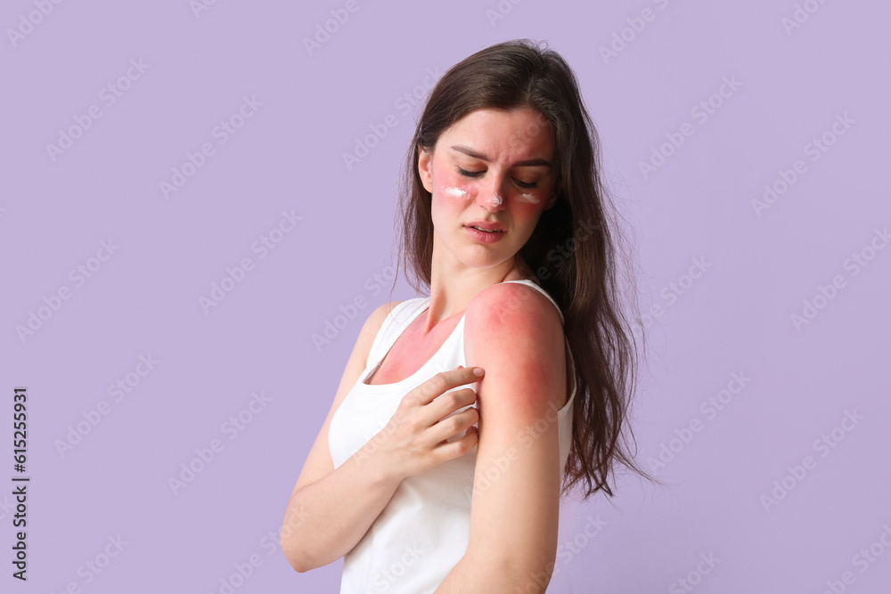 Allergic young woman with sunburned skin and cream on lilac background Allergic young woman with sunburned skin and cream on lilac background