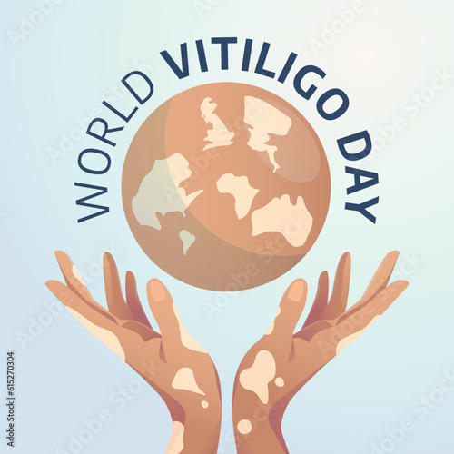 vector graphic of World Vitiligo Day good for World Vitiligo Day celebration. flat design. flyer design.flat illustration.