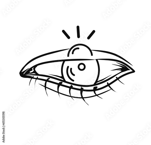 illustration vector, Human eye with swelled eyelid. Blepharitis.