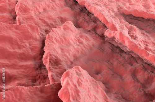Psoriasis skin surface - closeup view 3d illustration photo