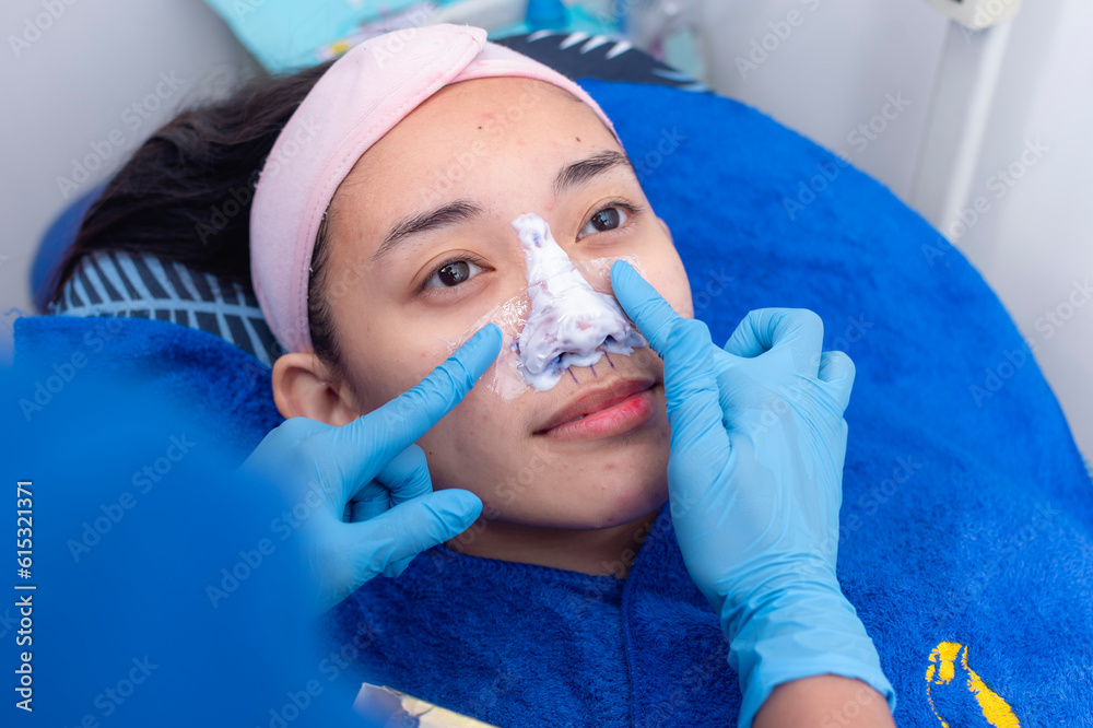 Applying topical anesthesia to the nose to numb the skin. Preoperative