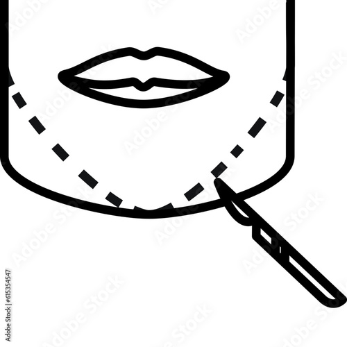 Chin surgery