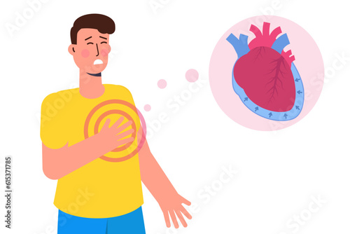 Pericardial effusion concept. Cardiovascular system medical vector illustration.
