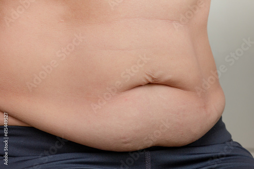 Woman cropped torso with sagging and bloated belly