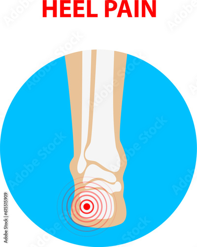 Heel pain. Human ankle joint icon back view. Vector illustration.