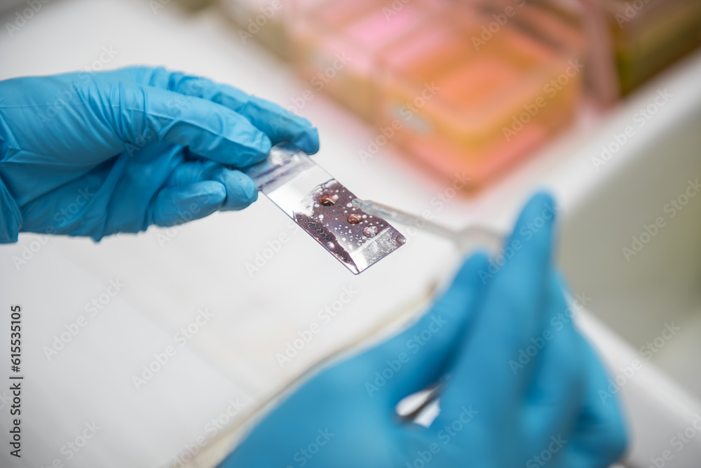 Medical scientists preparing cytology slides for pathologists to diagnose in hospital. Medical scientists preparing cytology slides for pathologists to diagnose in hospital.