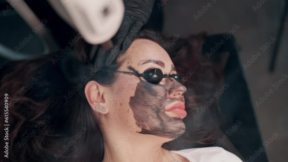 Facial cleansing procedure with laser carbon peeling in a spa salon. Close up top view.