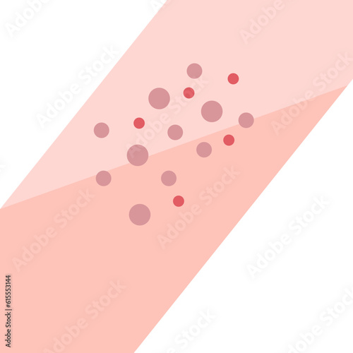 blisters  icon
