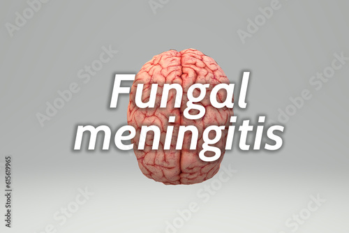 Background of fungal meningitis,Meningitis symptoms