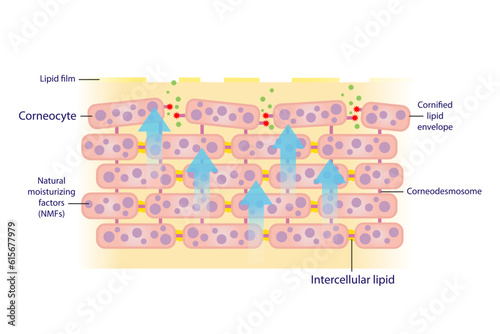 The mechanism of exfoliating corneocyte, skin cells vector isolated on white background. Corneodesmosome degraded by enzymes, sebum barrier decreased. This allows bacteria to get in skin. photo