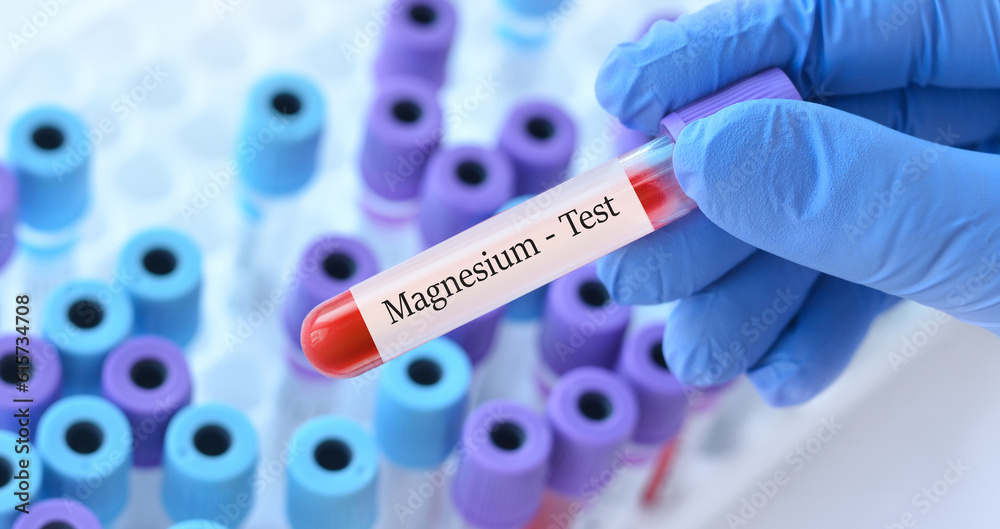 Obraz premium Doctor holding a test blood sample tube with Magnesium test on the background of medical test tubes with analyzes