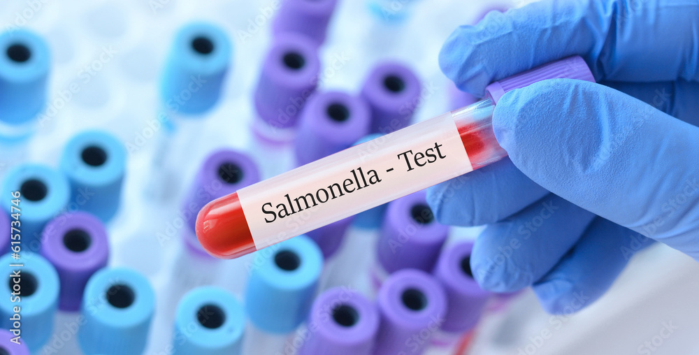 Obraz premium Doctor holding a test blood sample tube with Salmonella test on the background of medical test tubes with analyzes.