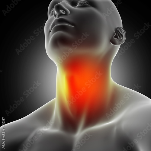 3D render of a male medical figure with sore throat