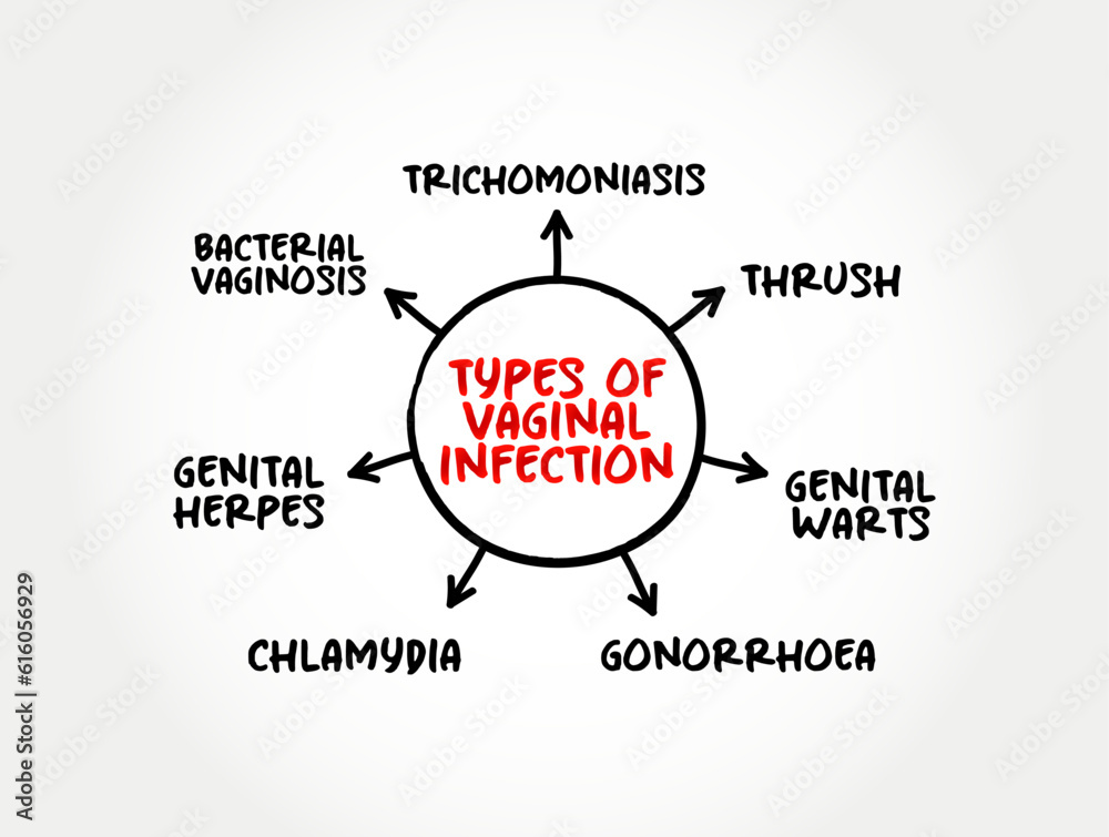 Types of vaginal infection mind map, text concept for presentations and reports