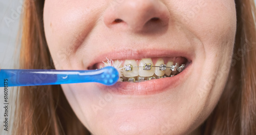 Woman begins to brush her teeth with round toothbrush for the care of braces. Close-up of the mouth, smile. Daily oral care, orthodontics, dentistry.