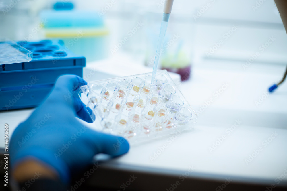 cell culture at the medicine  medical and cell culture laboratory  bioengineering 