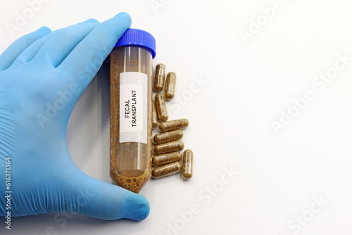 Fecal transplant or fecal matter transplant (MFT). Pills or medicines with fecal microbiota to cure persistent digestive diseases such as infection by Clostridium bacteria photo