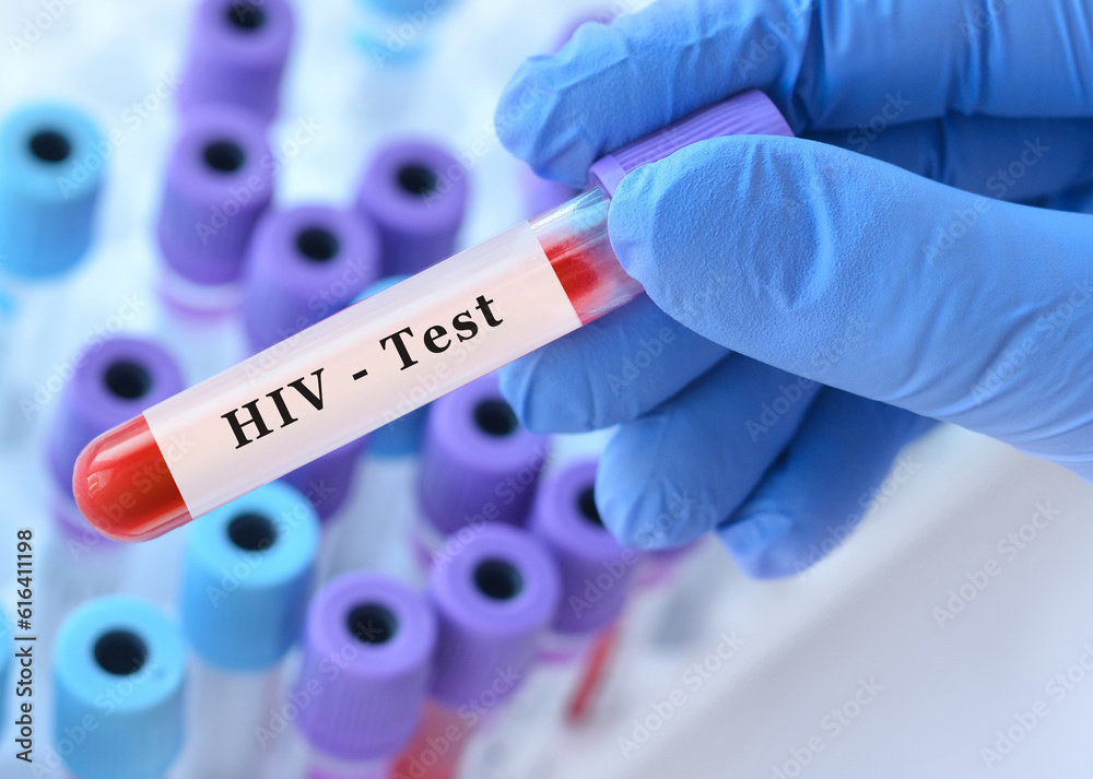 Obraz premium Doctor's hand holds test tube in blood on the background of test tubes with analyzes.Blood sample with HIV testing