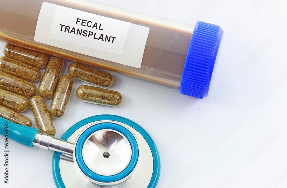 Fecal transplant or fecal matter transplant (FMT) to cure persistent digestive intestinal diseases such as infection by Clostridium  - obrazy, fototapety, plakaty 