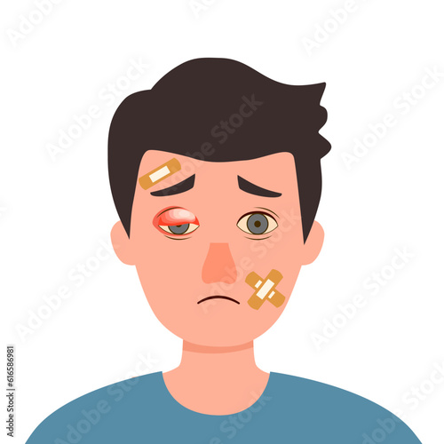 Man with swollen eye and injured face in flat design on white background.