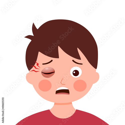Boy child with swollen eye in flat design on white background.