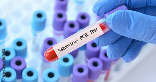 Doctor holding a test blood sample tube with Astrovirus PCR test on the background of medical test tubes with analyzes. photo