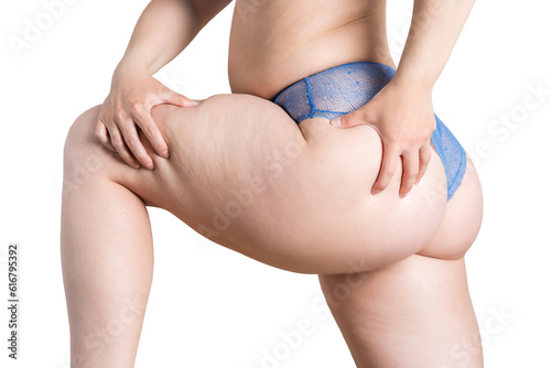 Overweight woman, fat thighs and buttocks, obesity female legs with cellulite photo