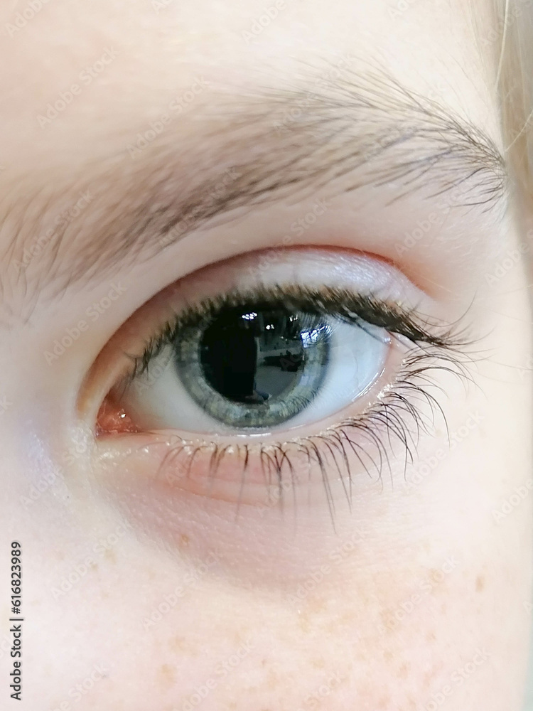 Fototapeta premium children's eye with dilated pupils