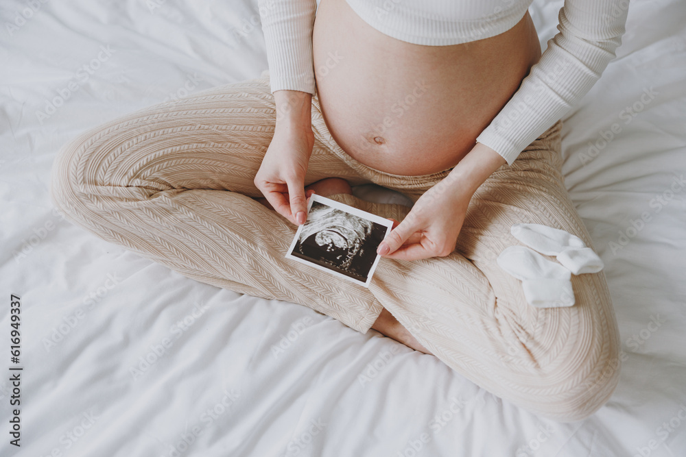 Cropped young pregnant woman wear white pyjamas hold in hand picture of ultrasound examination rest spend time in bedroom lounge home in own room hotel. Maternity family pregnancy expectation concept - obrazy, fototapety, plakaty 