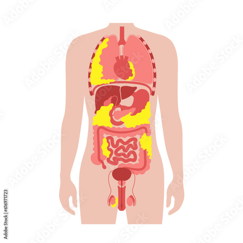 Visceral fat diagram