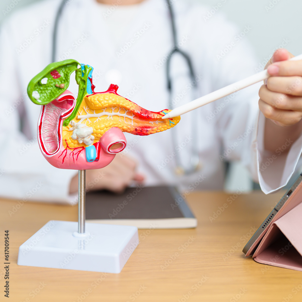 Doctor with human Pancreatitis anatomy model with Pancreas, Gallbladder