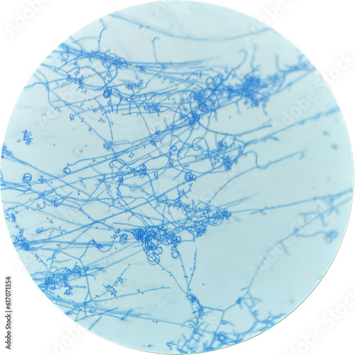Trichophyton mentagrophytes with microconidia and spiral hyphae. photo