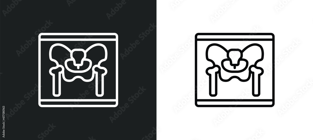 x ray of bones line icon in white and black colors. x ray of bones flat vector icon from x ray of bones collection for web, mobile apps and ui.