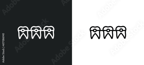 dental brackets line icon in white and black colors. dental brackets flat vector icon from dental brackets collection for web, mobile apps and ui.