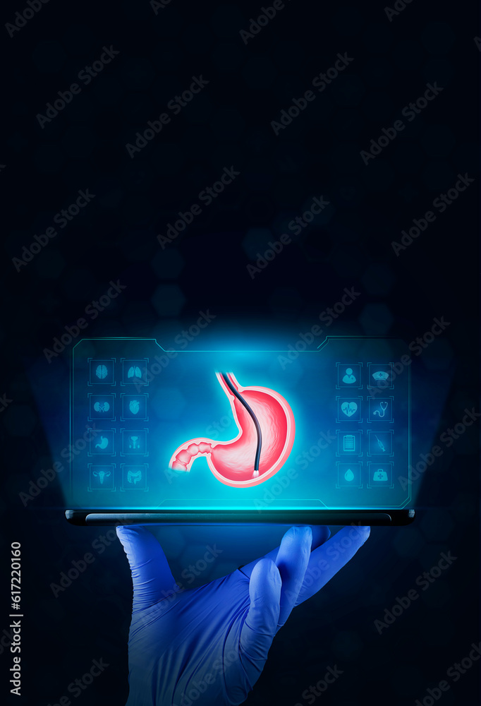 Endoscopic biopsy, esophagogastroduodenoscopy, EGD. The doctor's hand