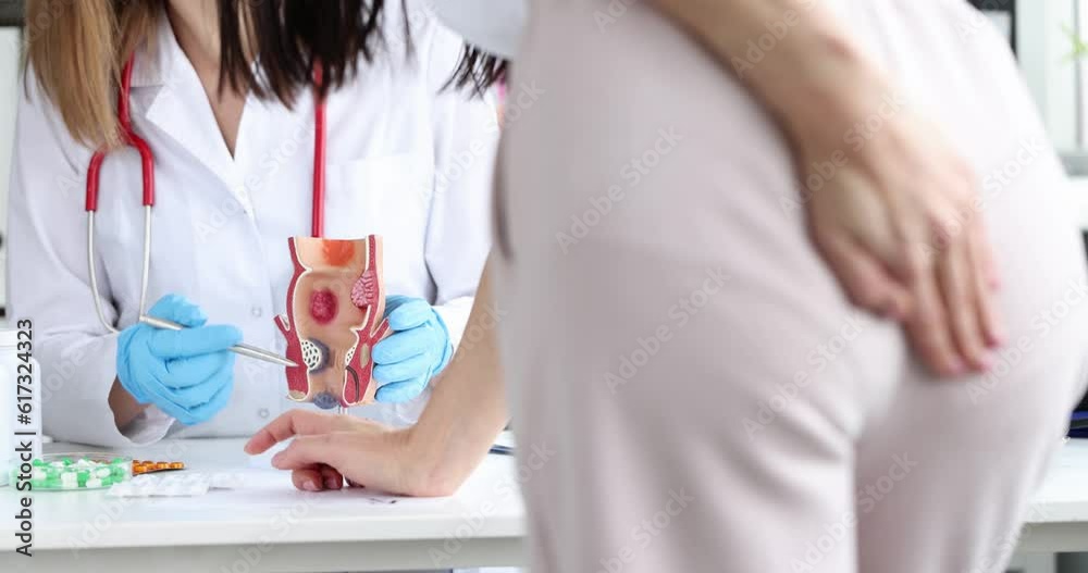 Doctor prescribes treatment to patient with bowel problems and model of unhealthy lower rectum