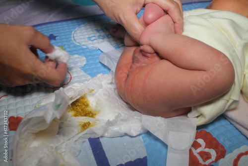 a baby boy is changing diapers due to water