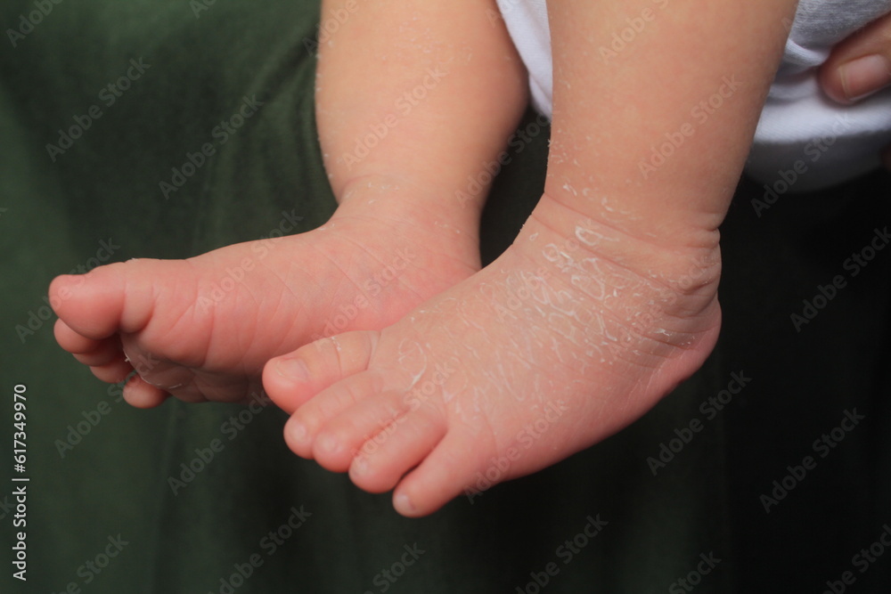 Newborn baby feet with soft, white and smooth skin texture
Newborn baby feet with soft, white and smooth skin texture