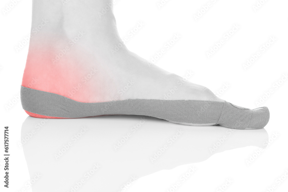 Therapeutic tape on female heel isolated on white background. Chronic pain, alternative medicine. Rehabilitation and physiotherapy. Therapeutic tape on female heel isolated on white background. Chronic pain, alternative medicine. Rehabilitation and physiotherapy.