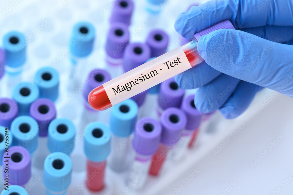 Obraz premium Doctor holding a test blood sample tube with Magnesium test on the background of medical test tubes with analyzes
