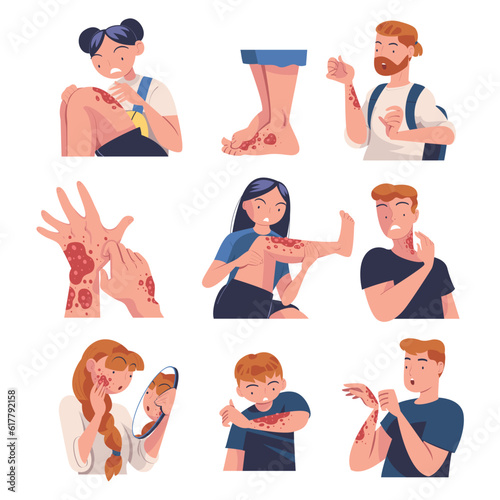 Skin Problems with People Character Suffering Scratching Itching Skin Vector Set