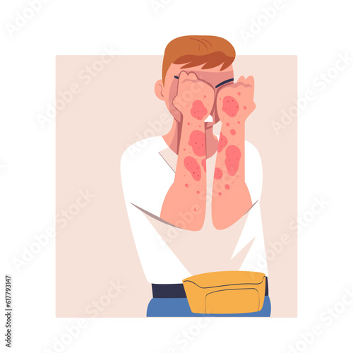 Man Character with Skin Problem Suffering from Itching Arms Vector Illustration