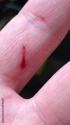 Unintentional wound: close-up of a finger displaying a recent cut and traces of blood