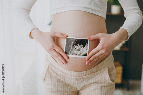 Fotomurale Cropped young pregnant woman in casual clothes stand near window hold in and ult