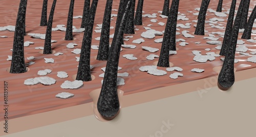 Bild auf Leinwand Hair follicles and dandruff under microscope - 3D illustration