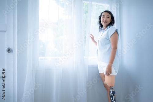Young asian woman smiling with prosthetics and looking through the window in the morning.