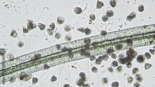 Vorticellidae colony on the Lemna root. Image from optical microscope with 10x objective