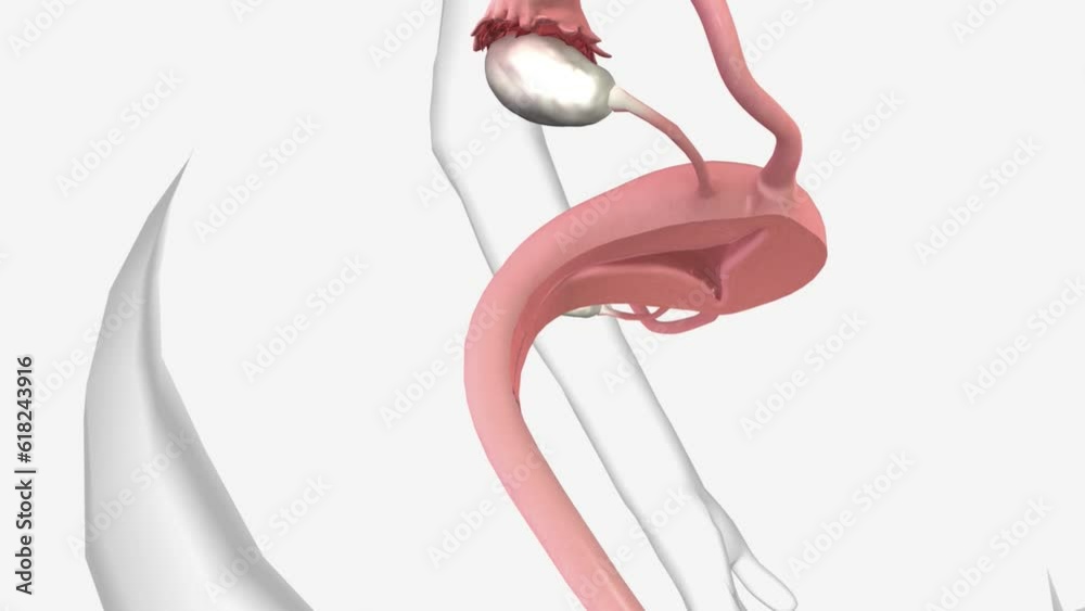 Cervical Cancer Symptoms and Signs Blood spots or light bleeding