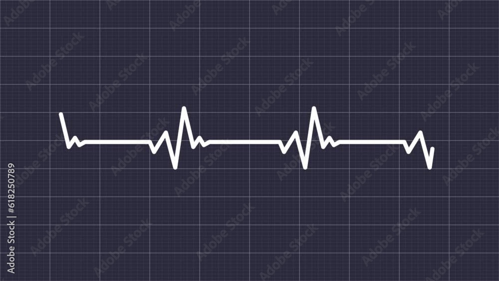 Heartbeat Pulse Rate animation with grid Background. Electrocardiogram