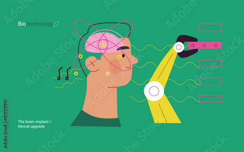 Bio Technology, Brain implant, Neural upgrade -modern flat vector concept illustration of brain implant, integration, enhanced cognitive abilities. Pushing boundaries of potential, neural upgrades